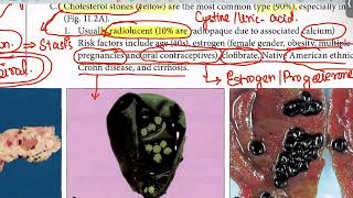 Biliary Atresia Cholelithiasis from first aid step 1USMLEUrduHindi [upl. by Aicilak]