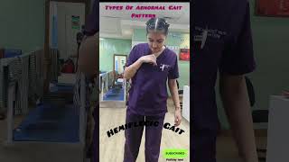 Abnormal Gait Pattern hemiplegia medical doctor physio viralvideo [upl. by Nnylsoj934]