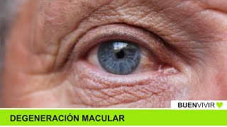 DEGENERACIÓN MACULAR  Consultorio Nítido  BUENVIVIR💚 071024 Canal 4 [upl. by Laeira]