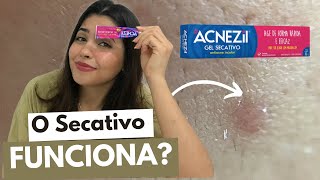 GEL SECATIVO ACNEZIL funciona E COMO USAR Minha experiência [upl. by Sessler]