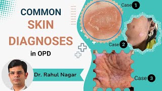 Common Skin Diagnoses In OPD [upl. by Scarrow]