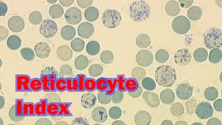 RETICULOCYTE INDICES [upl. by Lemire]