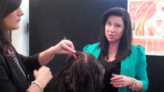 Hair Loss Natural Treatments with Microneedle Therapy [upl. by Oys]