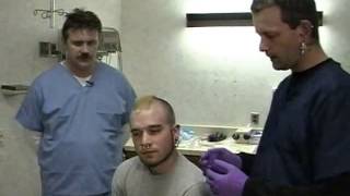 Body Piercing Removal in The Emergency Department  Excerpt from Bonus DVD [upl. by Trinia]