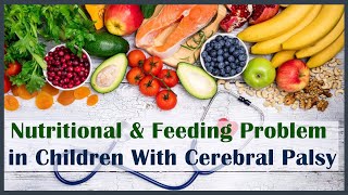 Nutritional amp Feeding Problem in Children With Cerebral Palsy  Trishla Foundation [upl. by Adolph]