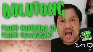 BULUTONG  Paano Nakukuha At Paano Maiiwasan ito [upl. by Rodolfo59]