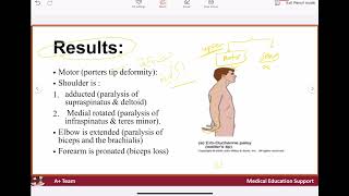 Brachial plexus injury [upl. by Lasky]