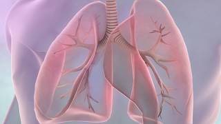 Symptoms of lung cancer [upl. by Ococ465]