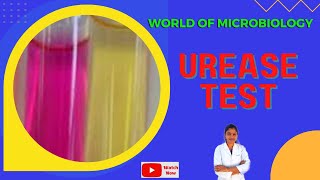 Urease Test Tamil  Biochemical Test for Identification of Bacteria  Christensens Medium [upl. by Lerraf]