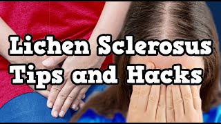 Lichen Sclerosus Tips and Hacks [upl. by Riancho]