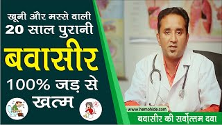 3 दिन में बवासीर Piles ठीक करें  piles treatment at home [upl. by Encratis]