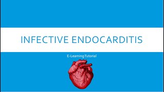 Infective Endocarditis [upl. by Ihtak]