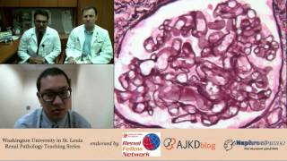 Web Episode 005  Renal Pathology Teaching Series Dr Gaut and Dr Gupta [upl. by Anivlek]