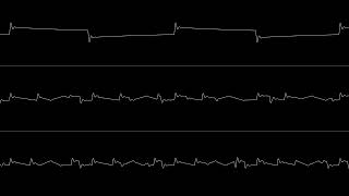 psych858o  NTWRK BRKDWN C64 oscilloscope view [upl. by Leva]