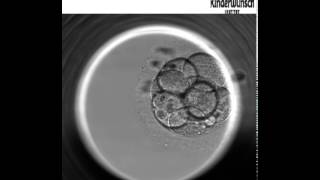 Die Embryo Entwicklung bis zur Blastozyste  Embryoskop [upl. by Ahseer]