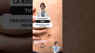 Comprendre et Prévenir la Rougeole  Guide pour les Infirmiers ide tutorial nurse measles tips [upl. by Trebloc]