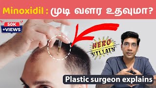 முடி வளர்ச்சிக்கு மினாக்ஸிடில் எப்படி பயன்படுத்துவது Minoxidil  Hair Loss clinic coimbatore [upl. by Mac535]