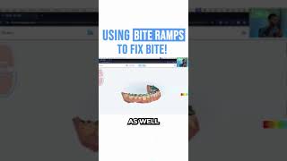 Using Bite Ramps To Fix Bite [upl. by Akirahs]