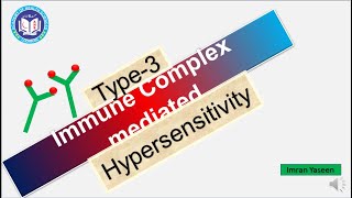 Type3 hypersensitivity Immune Complex Mediated in UrduHindi  Pathology  by Imran Yaseen [upl. by Sontag865]