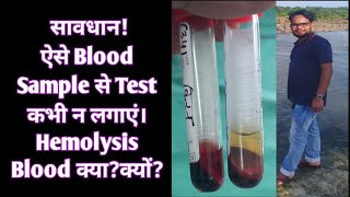 Hemolysis Blood क्या हैक्यों होता है  Hemolyzed Blood से Test क्यों नही लगाए [upl. by Sadiras268]