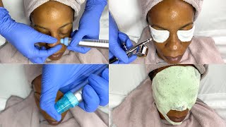 Hydrodermabrasion Facial with Oxygen Infusion Treatment [upl. by Liew328]