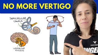 The 1 CAUSE Behind Vertigo [upl. by Eng]