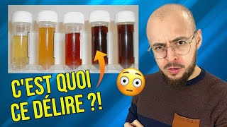 Que cache la COULEUR de votre URINE [upl. by Pages]