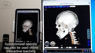 Start Medical Imagebased Teleconsultation using Web DICOM Viewer on iPad via Web Push Notification [upl. by Laeynad]