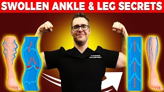 Lymphedema Treatment How to Get Rid of Swollen Feet Ankles amp Legs [upl. by Dlanor]