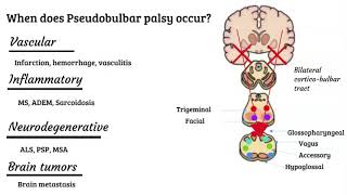 Bulbar vs pseudobulbar palsy [upl. by Tormoria]