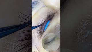 Eyelash planting Eyebrow transplant hair transplant eyebrow hairtransformation hairgoals [upl. by Onivla150]