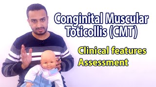 Congenital Muscular Torticollis assessment and clinical features [upl. by Otrebtuc517]