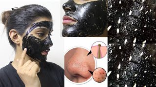 CHARCOAL Peel Off Mask Does It Work हिंदी ReviewSuper Style Tips [upl. by Aivatal]