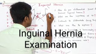 Inguinal Hernia Examination By Dr Dinusha [upl. by Aihsotal]