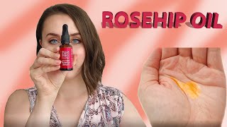 WHAT IS ROSEHIP OIL AND THE BENEFITS OF IT  DOCUMENTARY [upl. by Anawahs]