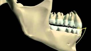 Mandibular Movement 3D [upl. by Gaultiero]