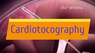 Cardiotocography Trailer [upl. by Ahseer]