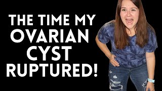 My Ovarian Cyst Ruptured Story Time [upl. by Obadiah]