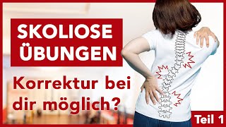 Effektive Skoliose Übungen für dein Training  Gegen Beschwerden  Fit amp Schmerzfrei [upl. by Amein]