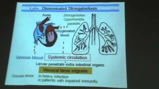 Dr Azza Parasitology Nematodes 4 strongyloides stercoralis capillaria philippinensis YouTu [upl. by Traggat]