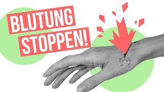 Druckverband  Erste Hilfe Tipp Wie wird‘s gemacht [upl. by Kcolttam]