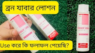 Clindacin Lotion  মুখের ব্রন ও চোখের নিচের কালো দাগ দূর করার লোশন  Incepta Pharmaceuticals Ltd [upl. by Neltiak]