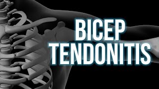 Bicep Tendonitis 3 steps to start the healing [upl. by Atilegna808]