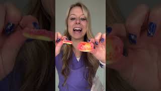 FREEZE DRIED CANDY VS BRACES 🥶🍭 PEACH RINGS ORTHODONTIST TRIES AND REACTS ASMR CRUNCHY TEETH 🦷 [upl. by Elehcir]