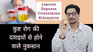 कुष्ट रोग की दवाइयों से होने वाले नुकसान  Sideeffects of Leprosy Medicines  Dapsone Clofazimine [upl. by Largent]