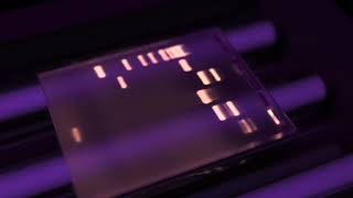 Gel Electrophoresis and Gel Analysis [upl. by Forcier]