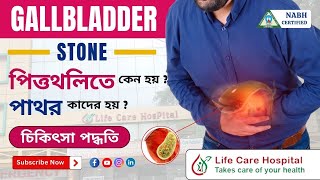 Gallstones Causes and Prevention  Dr A Rahaman [upl. by Wanids]