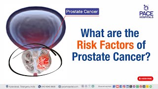 Risk Factors of Prostate Cancer  What are the Risk Factors of Prostate Cancer  prostatecancer [upl. by Annua]