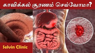 KAVIKKAL CHOORANAM I SIDDHA TRATIONAL MEDICINE PREPARATION I அல்சர் நோய்க்கு I LIVE I Selvin Clinic [upl. by Ursala719]