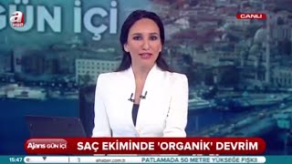 A Haber Organik Saç Ekimi [upl. by Rakel]